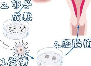 榆林府谷县试管婴儿哪家好，榆林府谷医院